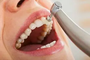 How Long Should a Typical Dental Cleaning Take?