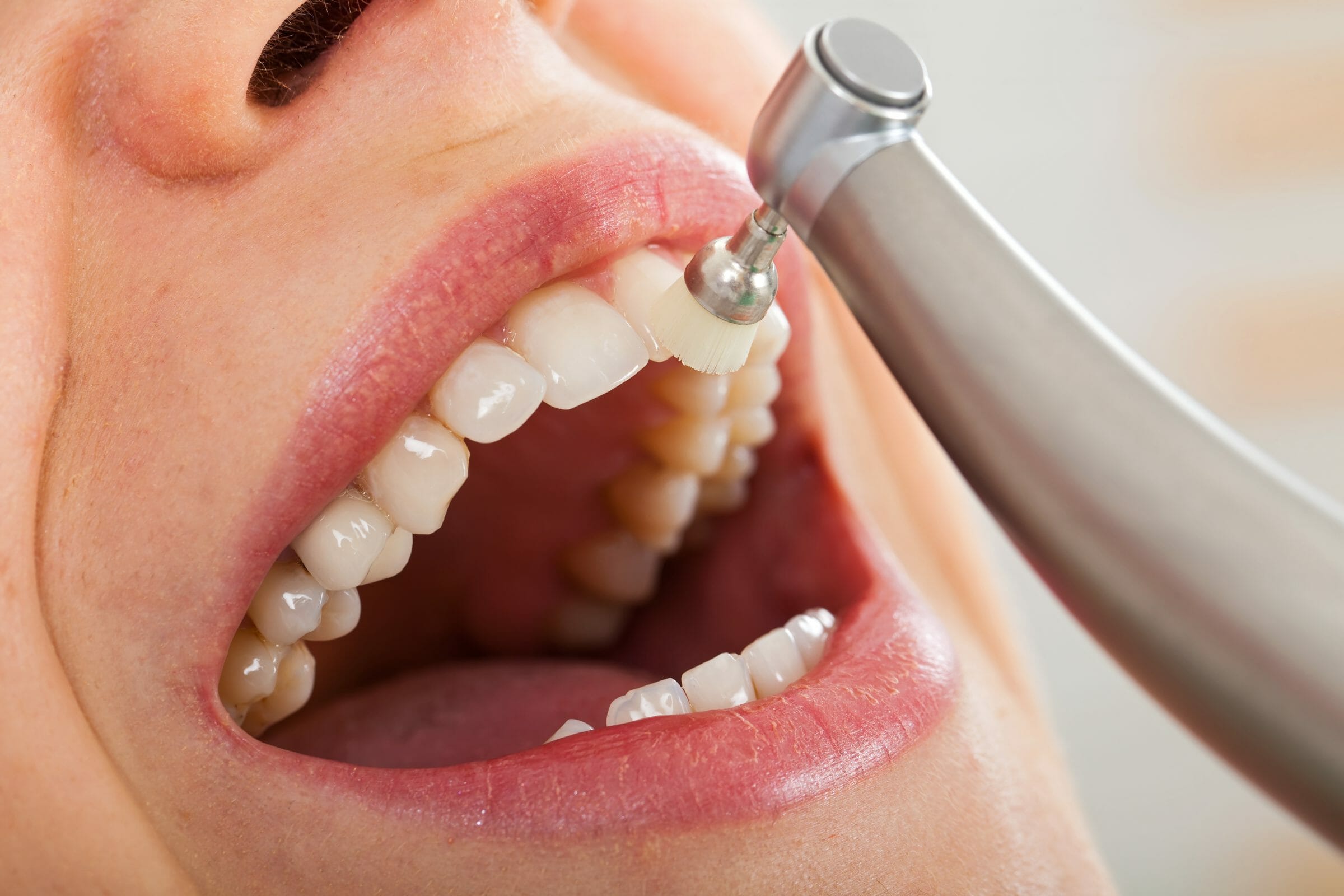 how-long-should-a-dental-cleaning-take-dental-checkup