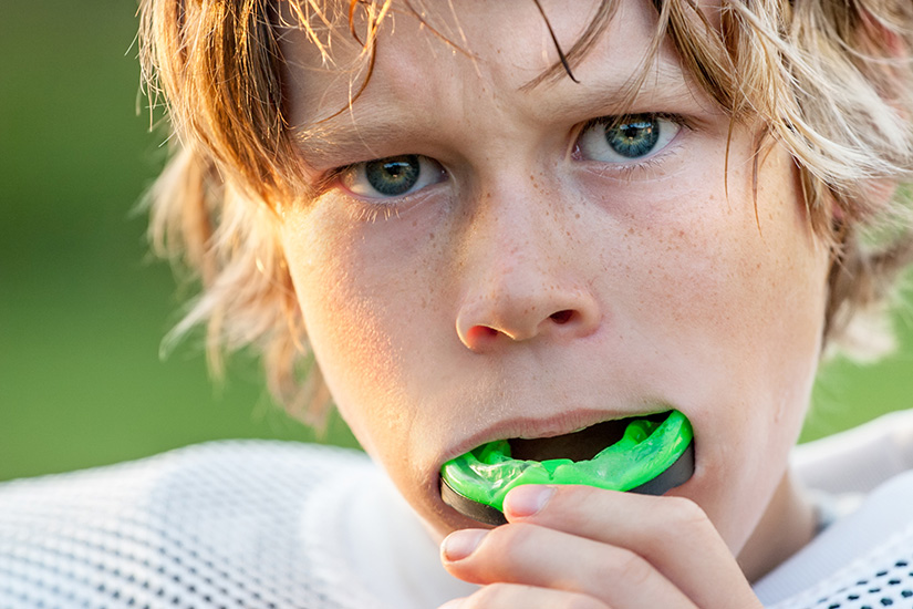 The Importance of Wearing a Mouth Guard