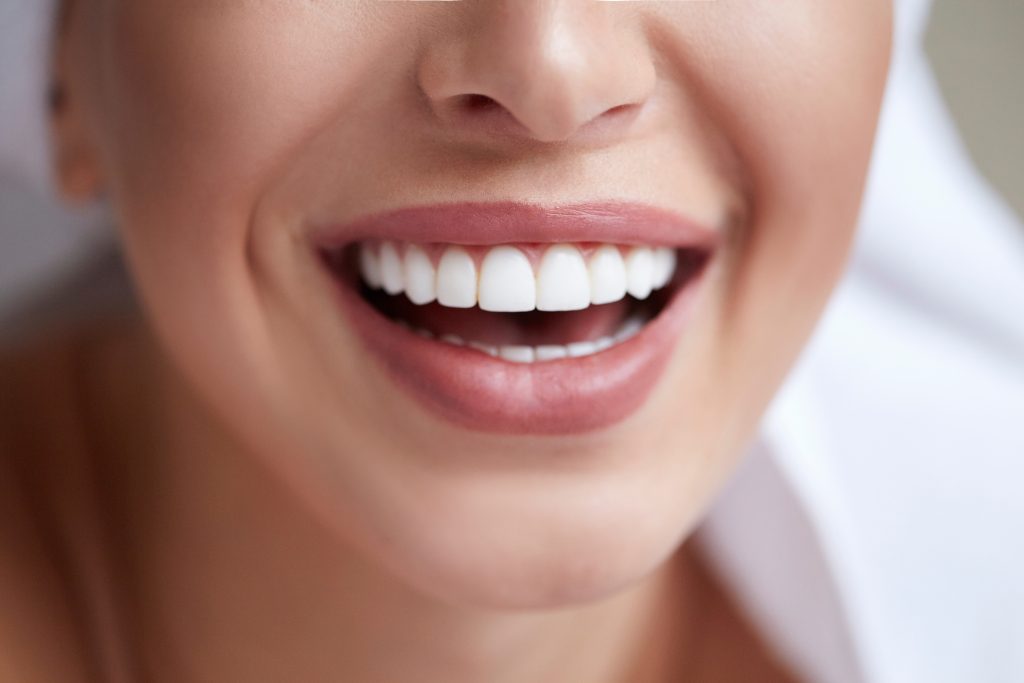 woman smiling with white teeth