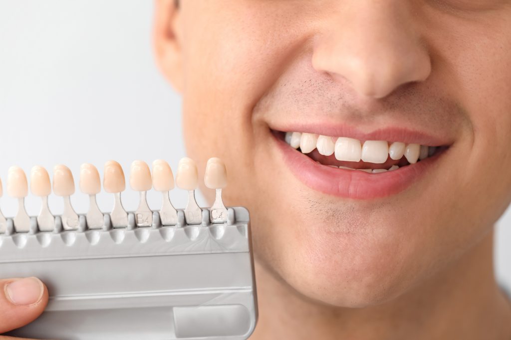 young man choosing dental crowns