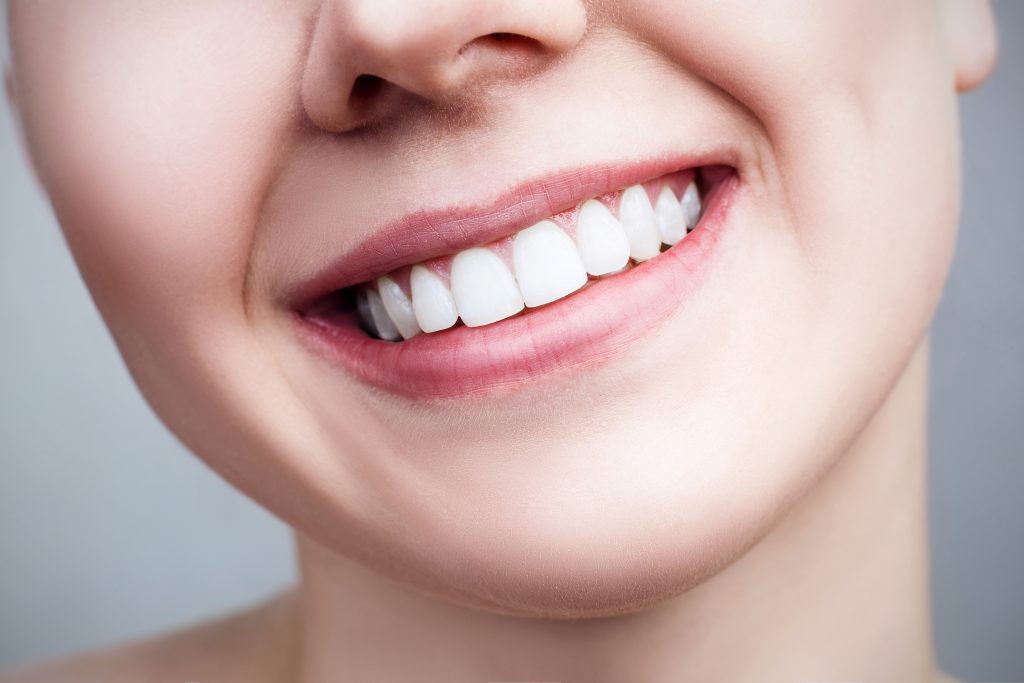 closeup of woman smiling with teeth