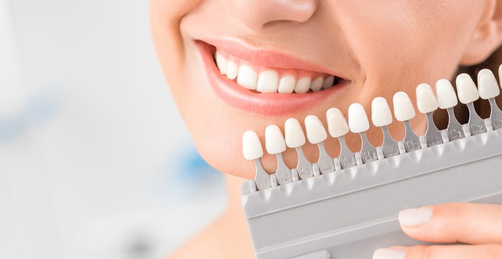 woman choosing shade of tooth whitening