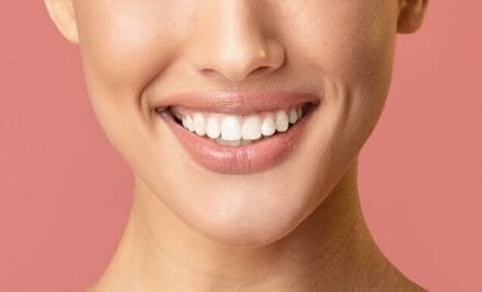 The Best Way to Whiter Teeth