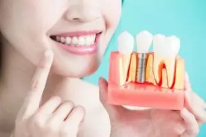 woman holding dental implant model