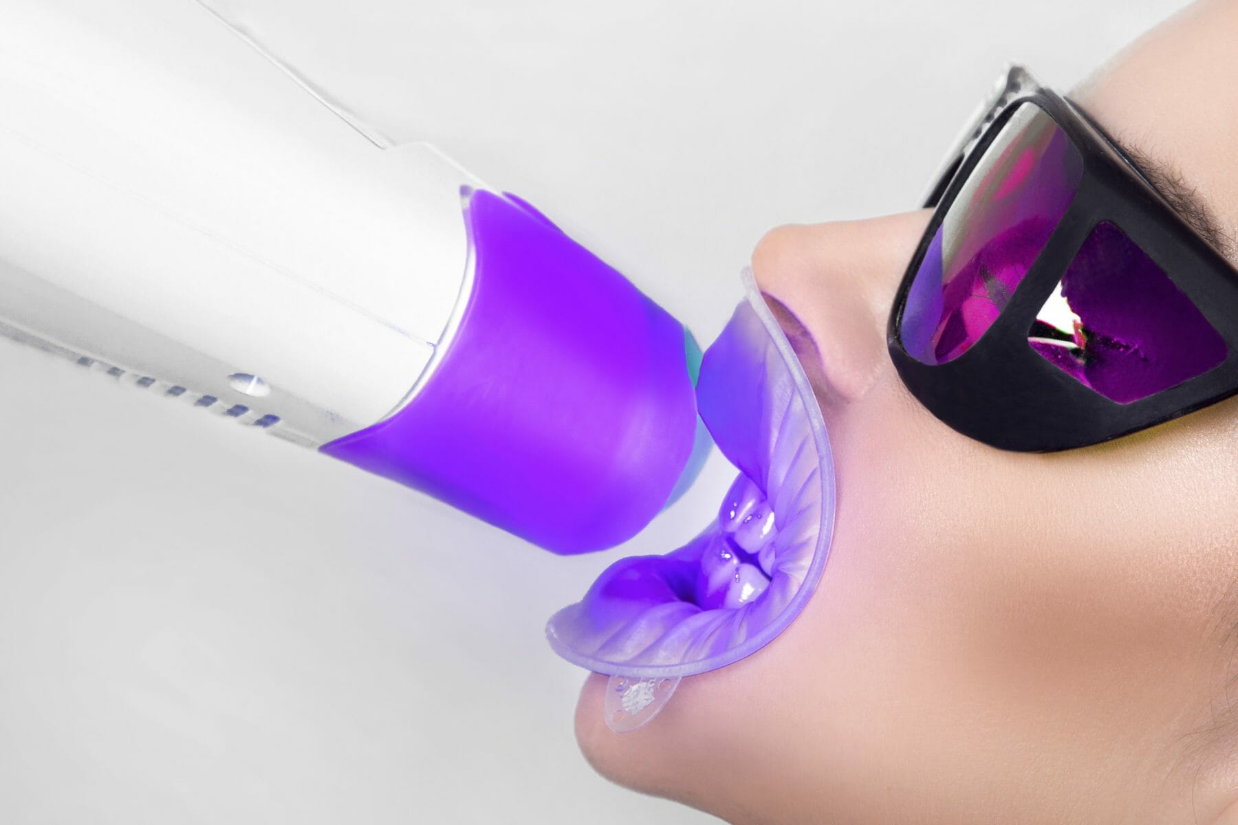 Teeth Whitening Home vs. O'Connor Dental Care Dentist Office